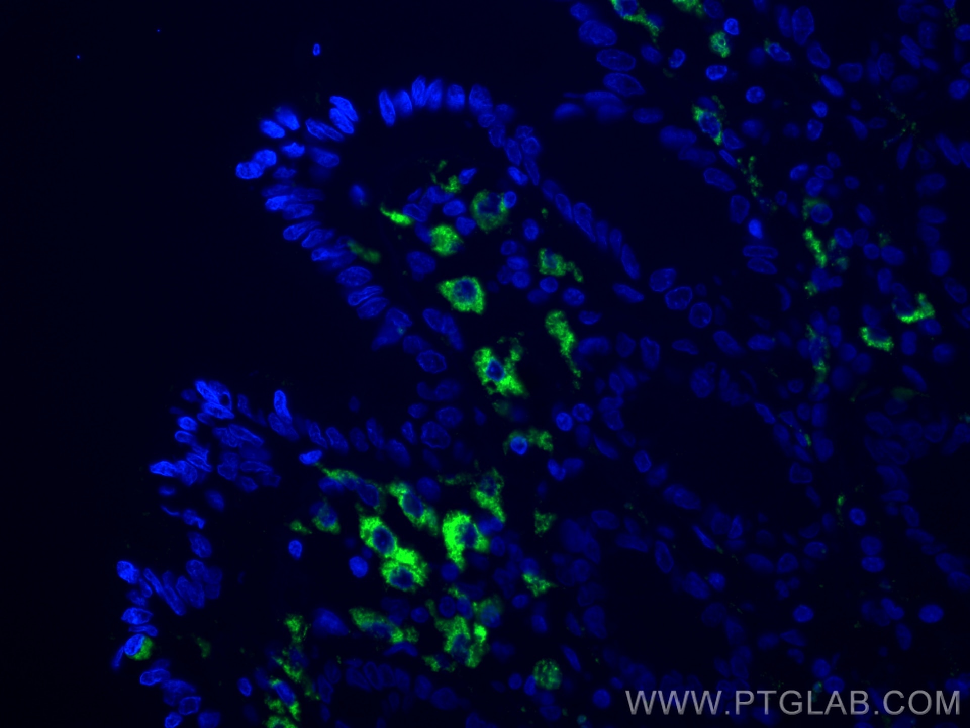 IF Staining of human colon using 25747-1-AP