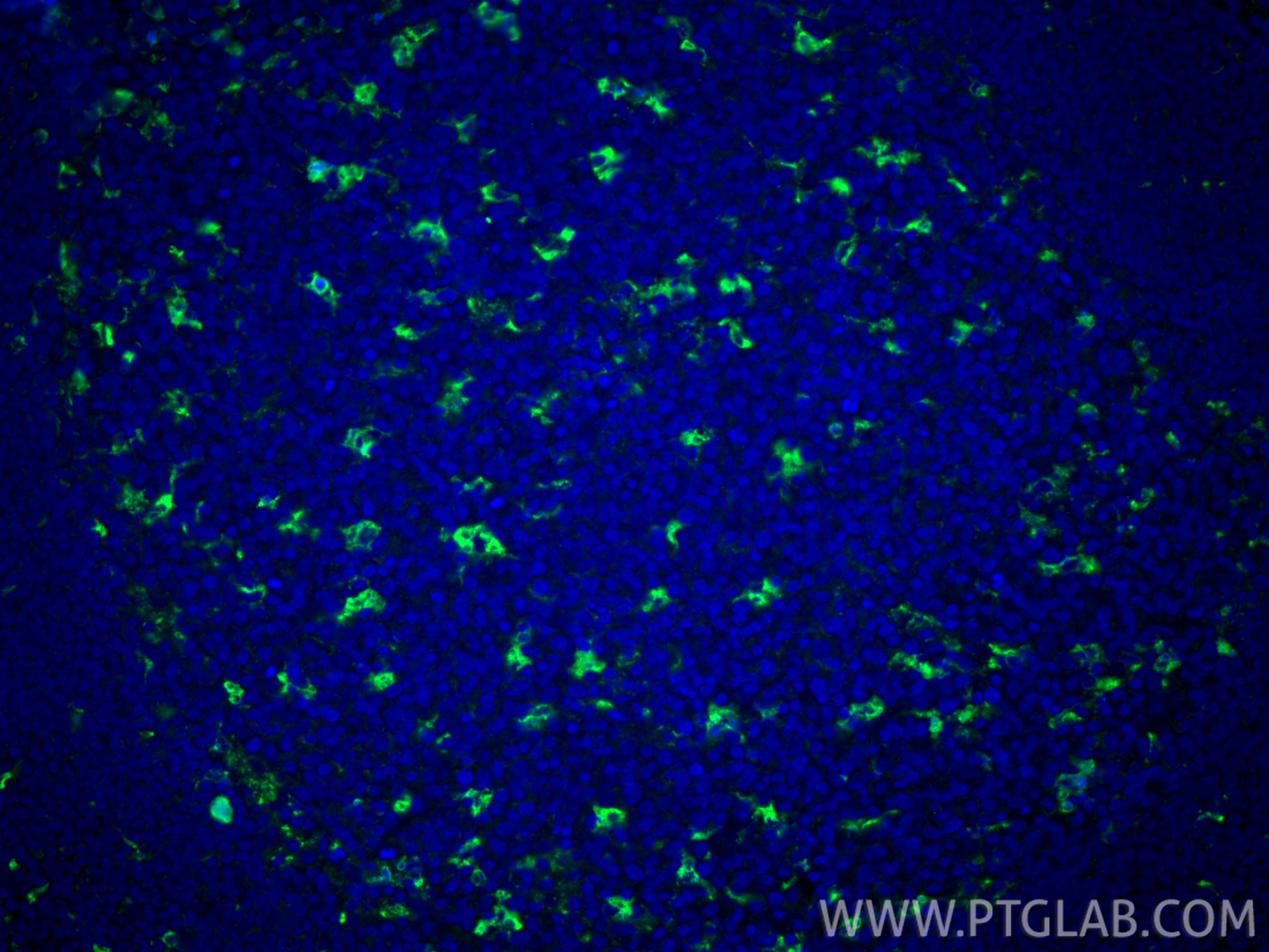 Immunofluorescence (IF) / fluorescent staining of human tonsillitis tissue using CD68 Polyclonal antibody (25747-1-AP)