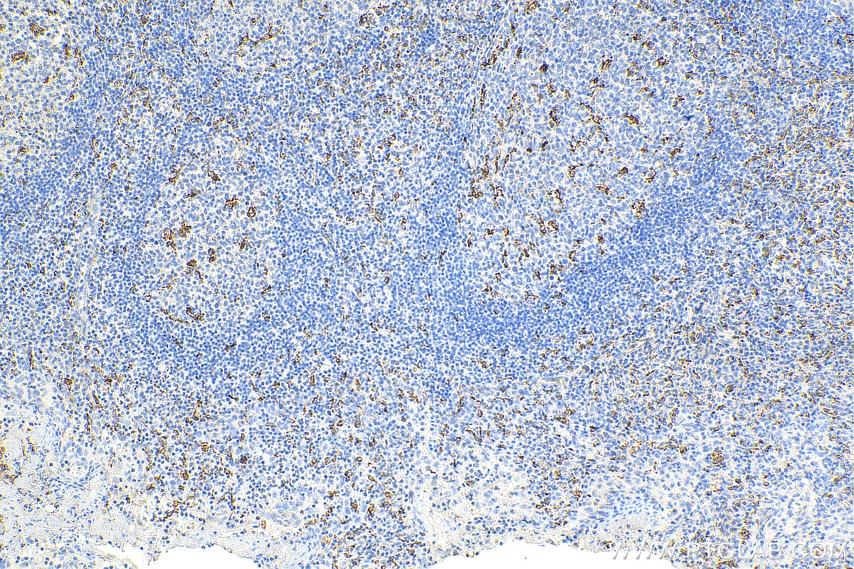 IHC staining of human tonsillitis using 25747-1-AP