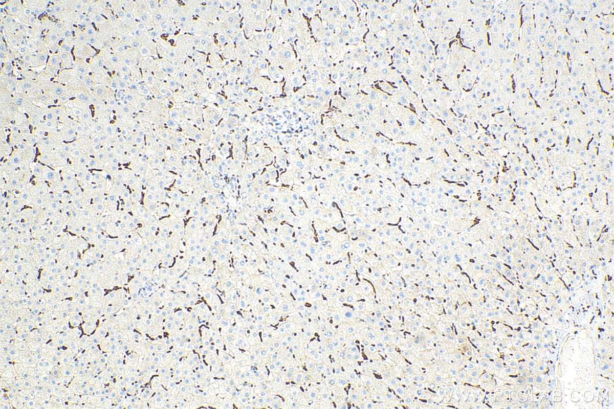 Immunohistochemistry (IHC) staining of human liver tissue using CD68 Polyclonal antibody (25747-1-AP)