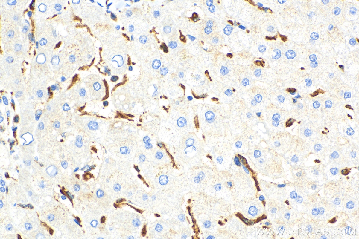 Immunohistochemistry (IHC) staining of human liver tissue using CD68 Polyclonal antibody (25747-1-AP)