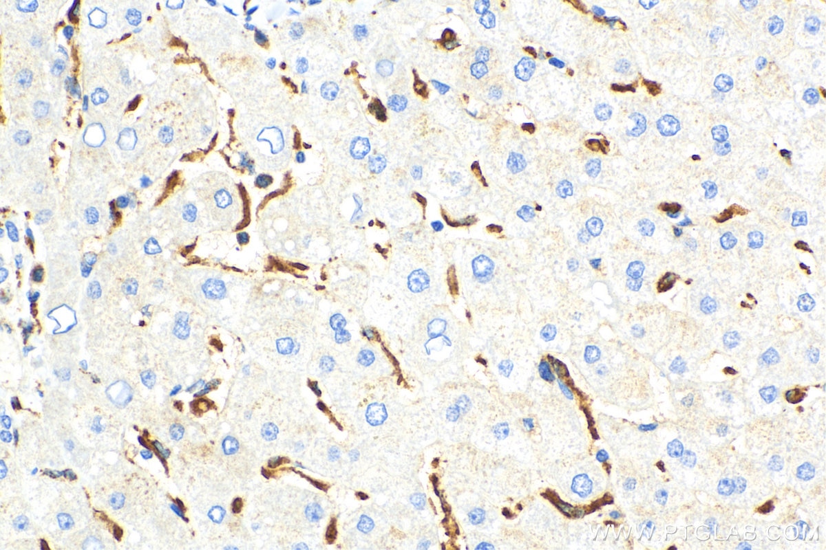 IHC staining of human liver using 25747-1-AP