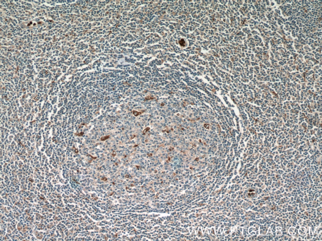 CD68 Polyclonal antibody