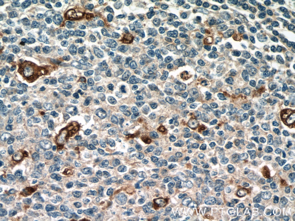 CD68 Polyclonal antibody