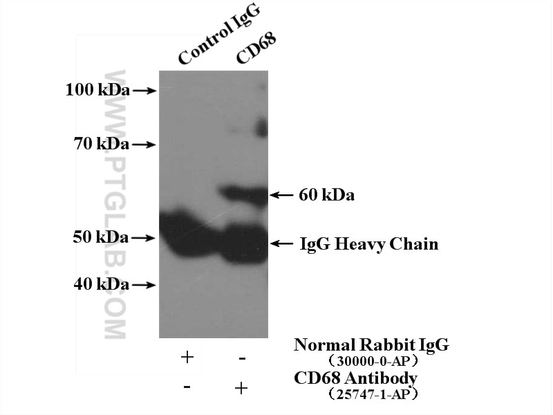 Immunoprecipitation (IP) experiment of RAW 264.7 cells using CD68 Polyclonal antibody (25747-1-AP)
