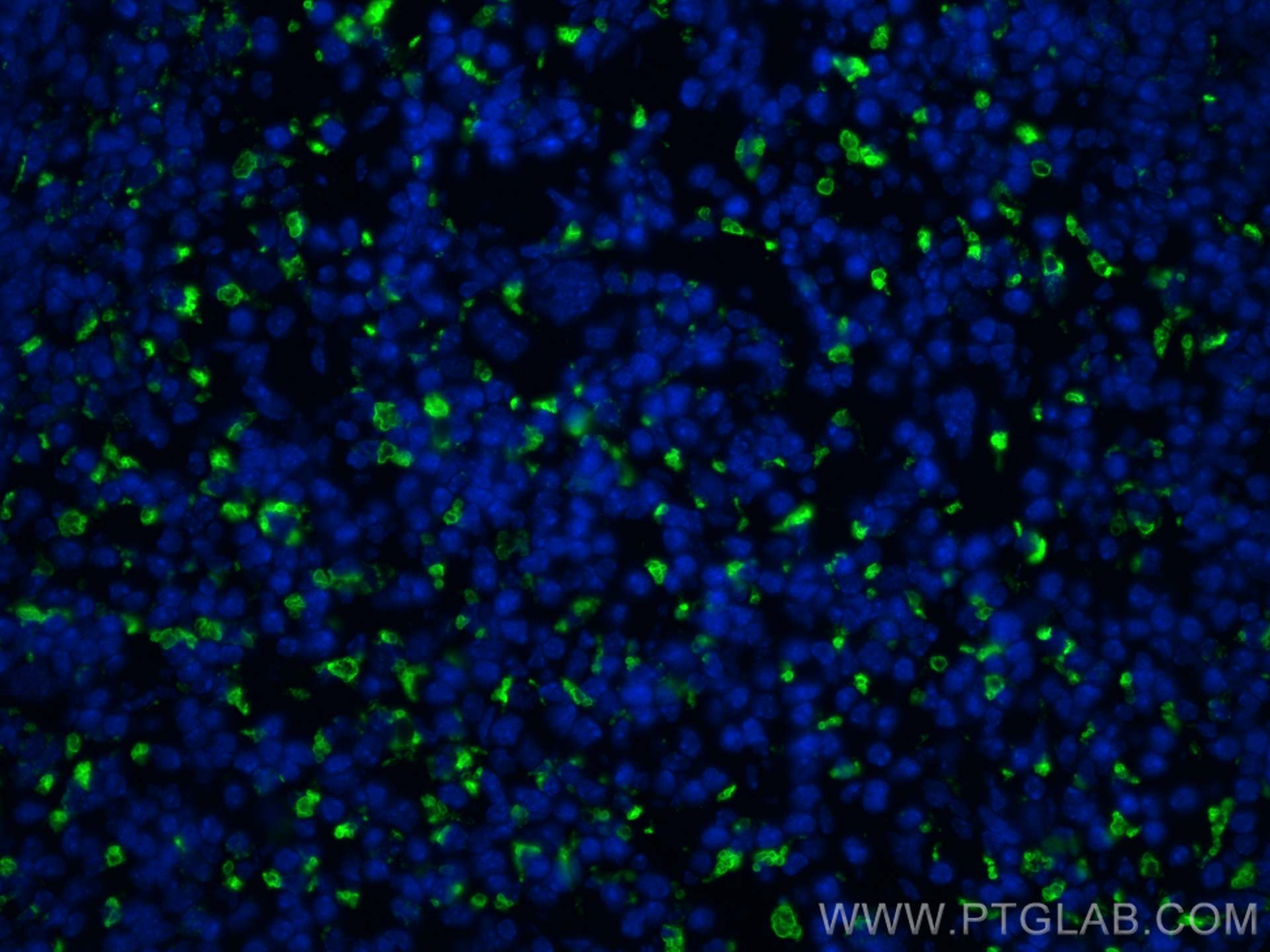 Immunofluorescence (IF) / fluorescent staining of mouse spleen tissue using CD68 Polyclonal antibody (30929-1-AP)