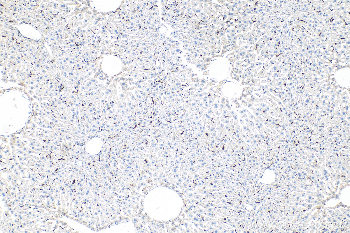 Immunohistochemistry (IHC) staining of mouse liver tissue using CD68 Polyclonal antibody (30929-1-AP)