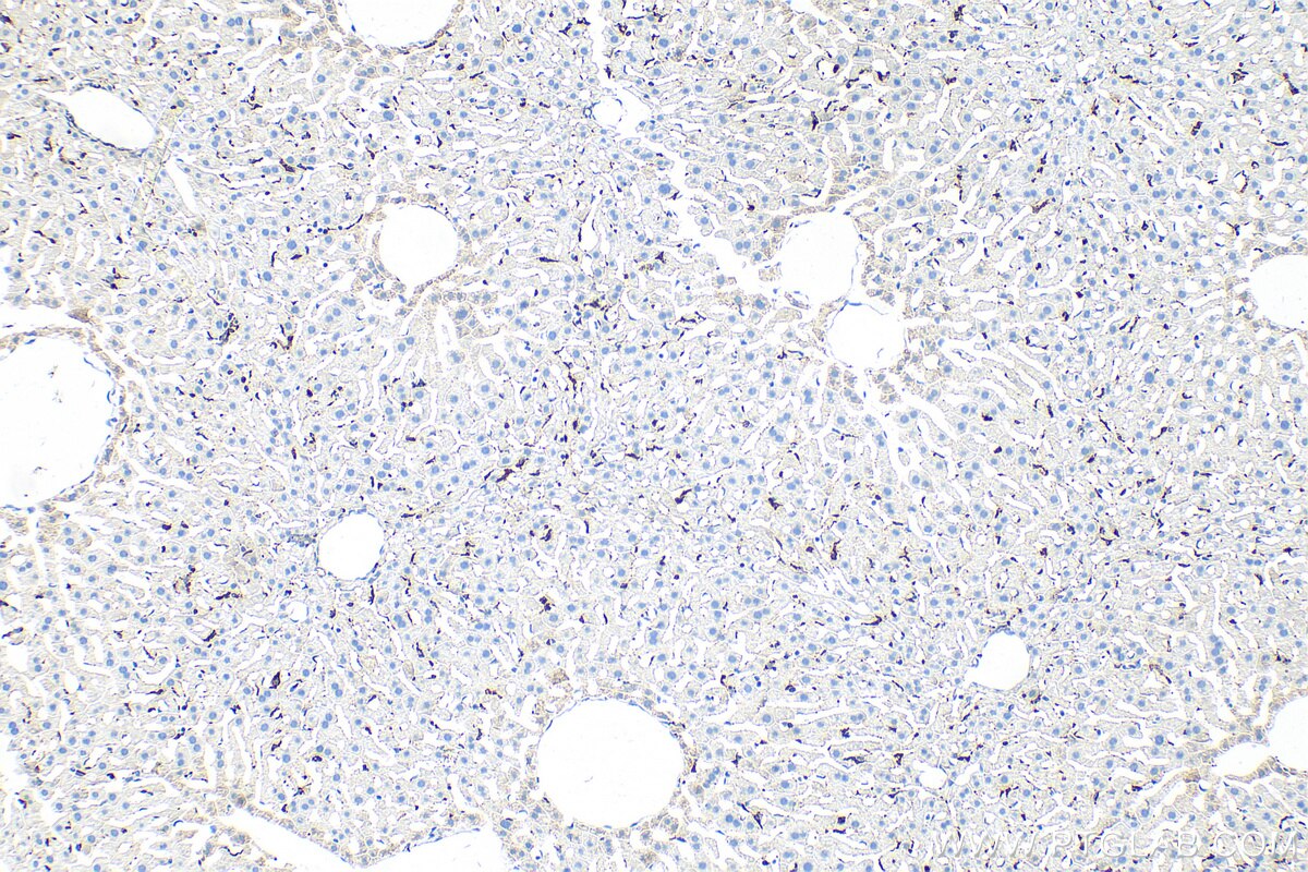 Immunohistochemistry (IHC) staining of mouse liver tissue using CD68 Polyclonal antibody (30929-1-AP)