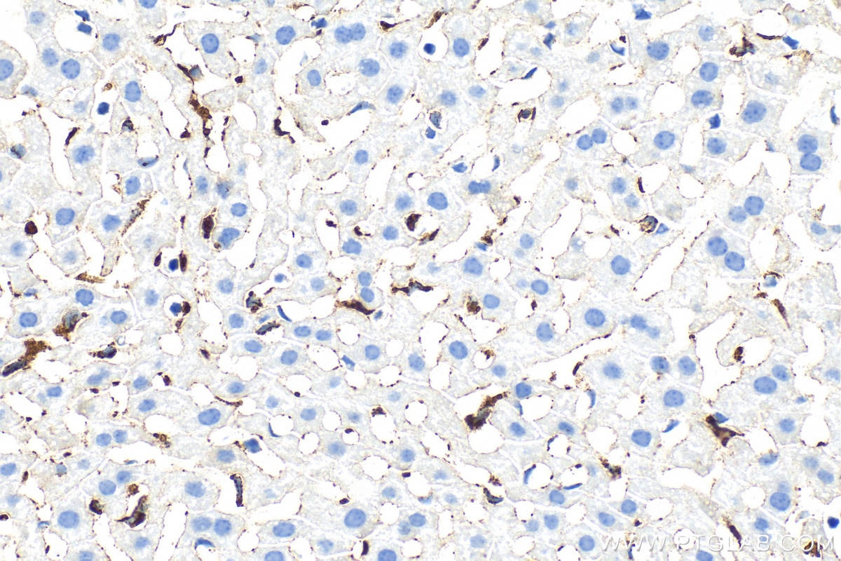 Immunohistochemistry (IHC) staining of mouse liver tissue using CD68 Polyclonal antibody (30929-1-AP)
