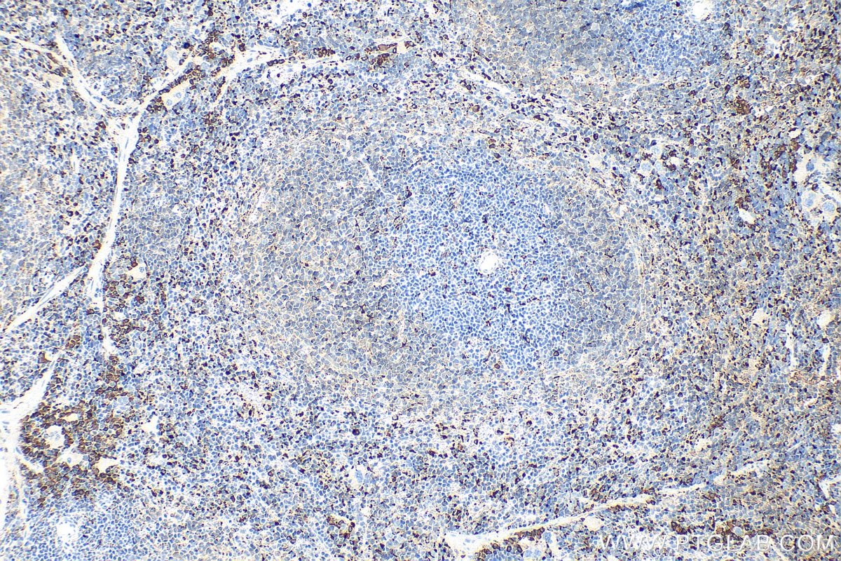 Immunohistochemistry (IHC) staining of mouse spleen tissue using CD68 Polyclonal antibody (30929-1-AP)