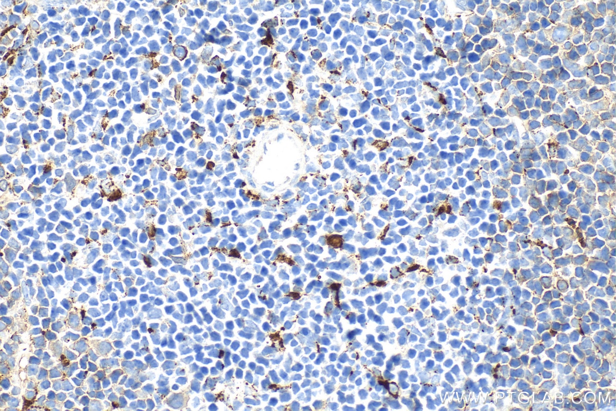 Immunohistochemistry (IHC) staining of mouse spleen tissue using CD68 Polyclonal antibody (30929-1-AP)