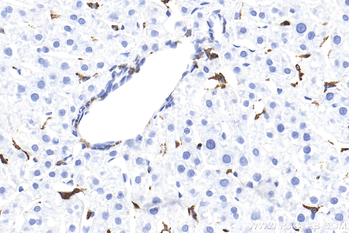 Immunohistochemistry (IHC) staining of rat liver tissue using CD68 Polyclonal antibody (30929-1-AP)