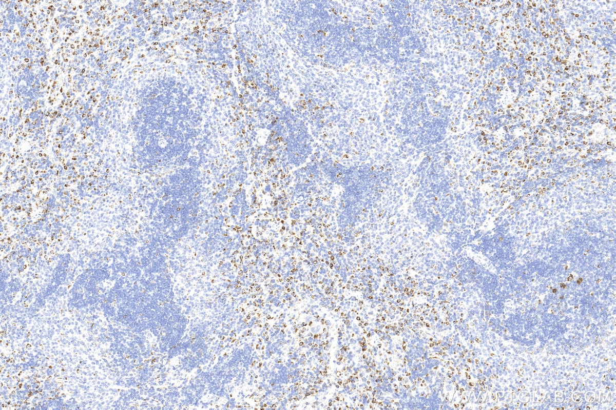 Immunohistochemistry (IHC) staining of rat spleen tissue using CD68 Polyclonal antibody (30929-1-AP)