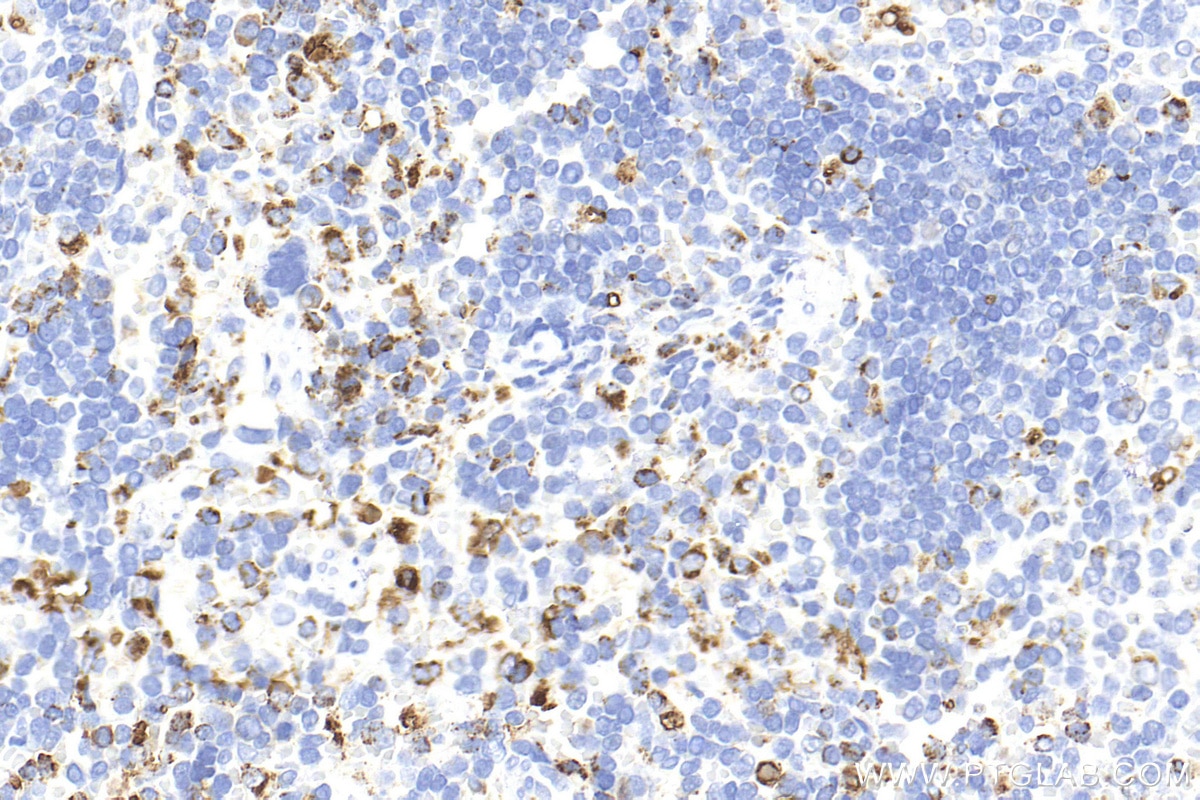 Immunohistochemistry (IHC) staining of rat spleen tissue using CD68 Polyclonal antibody (30929-1-AP)