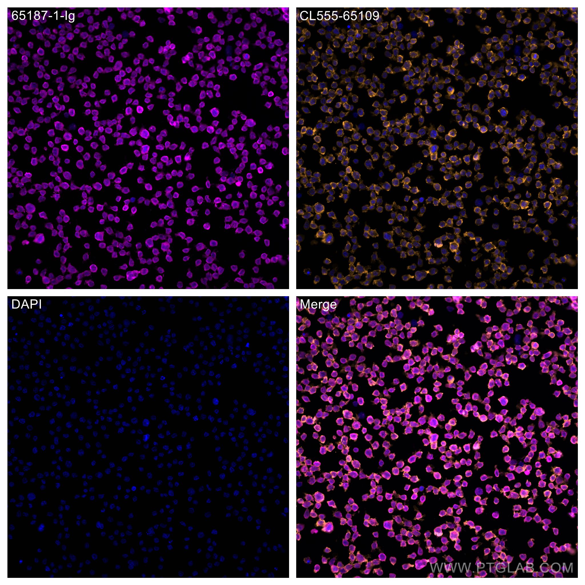 Immunofluorescence (IF) / fluorescent staining of THP-1 cells using Anti-Human CD68 (Y1/82A) (65187-1-Ig)