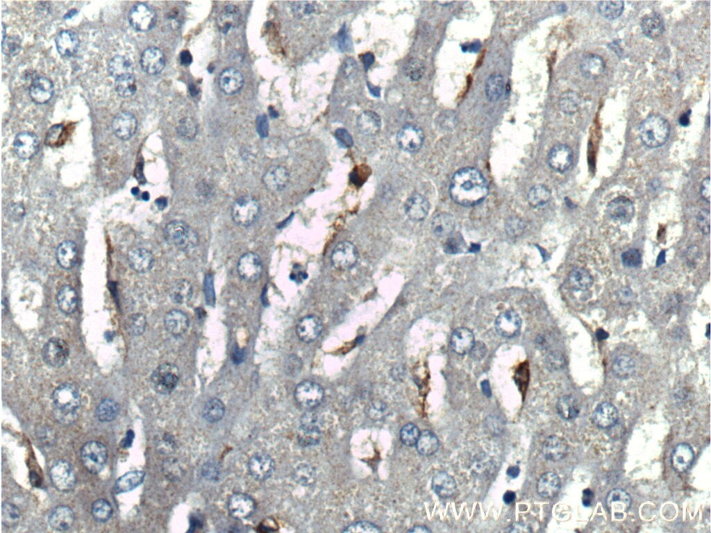 CD68 Monoclonal antibody