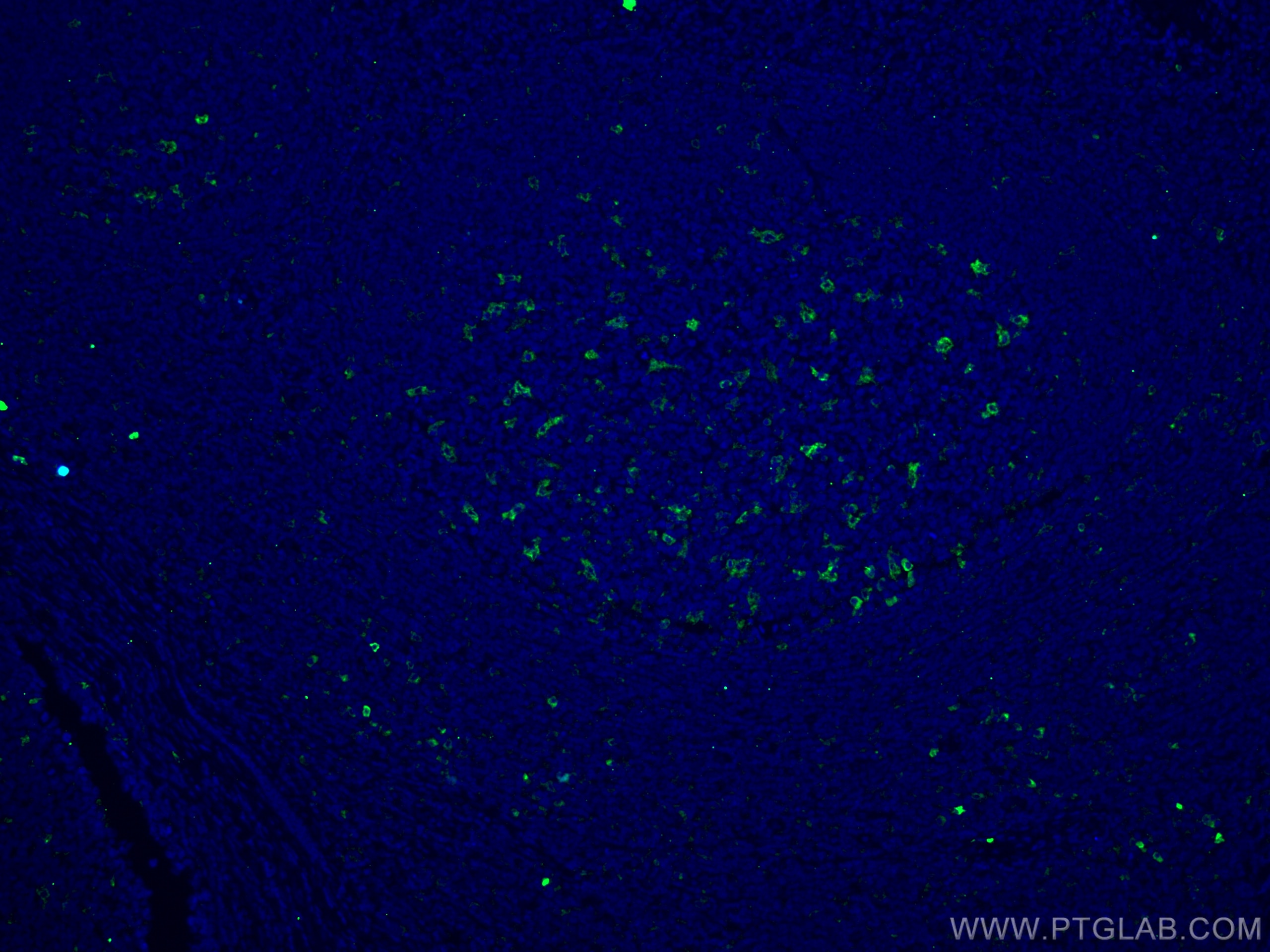 Immunofluorescence (IF) / fluorescent staining of human tonsillitis tissue using CD68 Monoclonal antibody (66231-2-Ig)