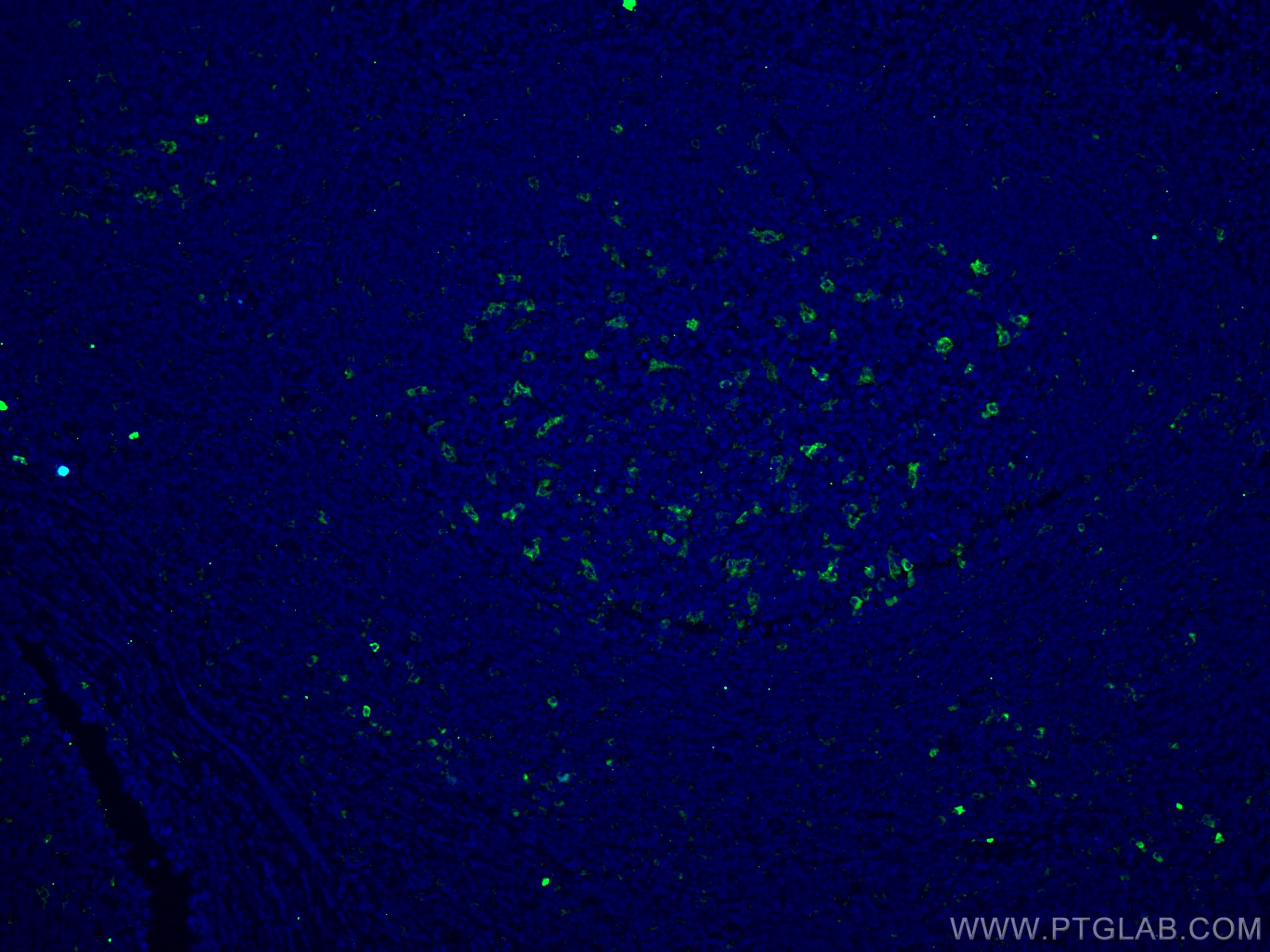 IF Staining of human tonsillitis using 66231-2-Ig