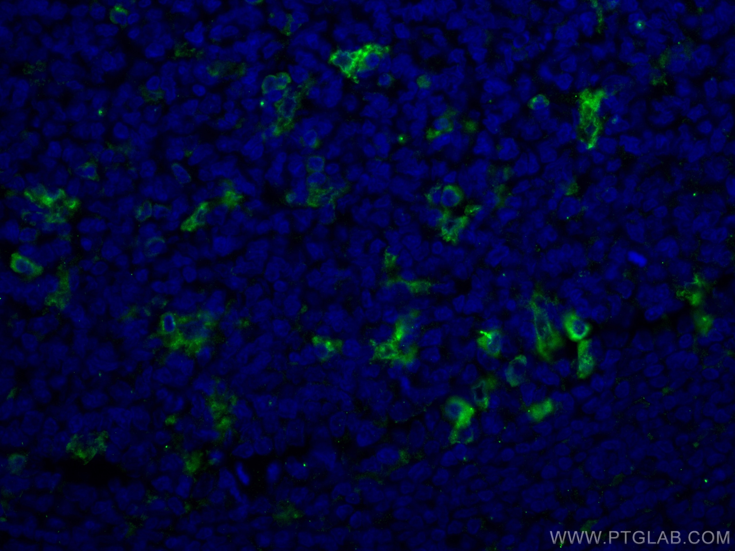 Immunofluorescence (IF) / fluorescent staining of human tonsillitis tissue using CD68 Monoclonal antibody (66231-2-Ig)