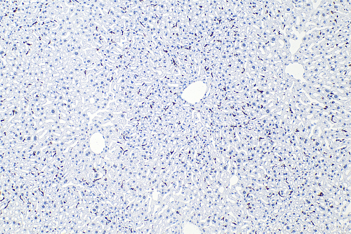 Immunohistochemistry (IHC) staining of mouse liver tissue using CD68 Recombinant antibody (83014-5-RR)