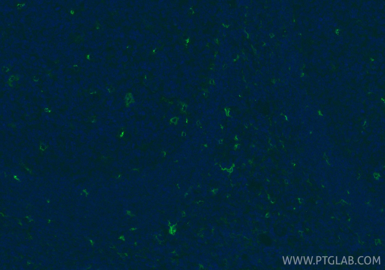 Immunofluorescence (IF) / fluorescent staining of human tonsillitis tissue using CD68 Recombinant monoclonal antibody (84596-4-RR)