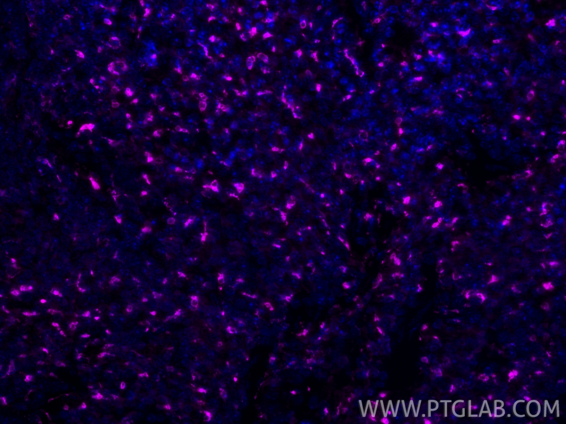 IF Staining of mouse spleen using APC-83014-5 Immunofluorescence (IF) / fluorescent staining of mouse spleen tissue using APC-conjugated CD68 Recombinant monoclonal antibod (APC-83014-5)