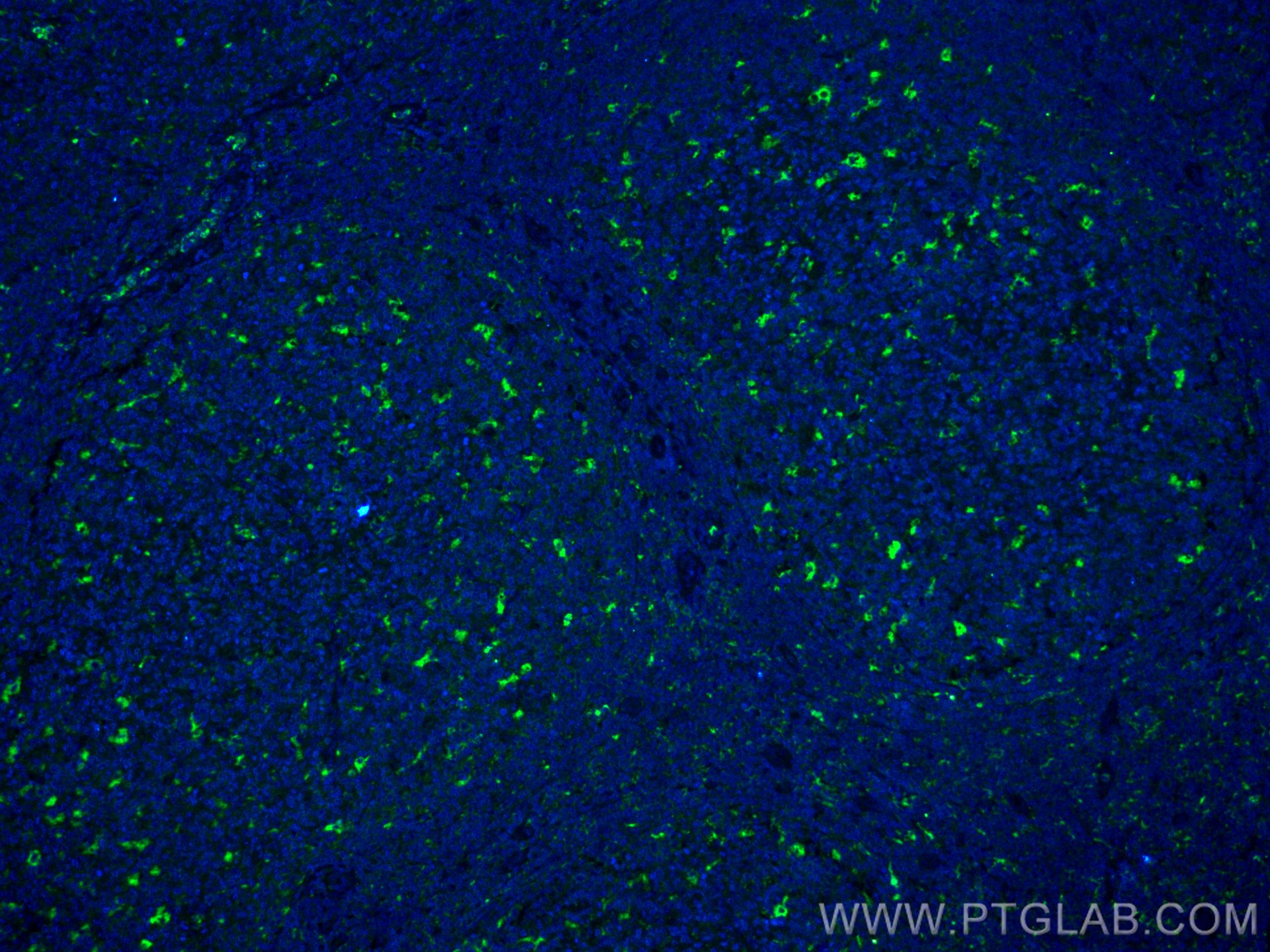 Immunofluorescence (IF) / fluorescent staining of human tonsillitis tissue using CoraLite® Plus 488-conjugated CD68 Polyclonal anti (CL488-25747)