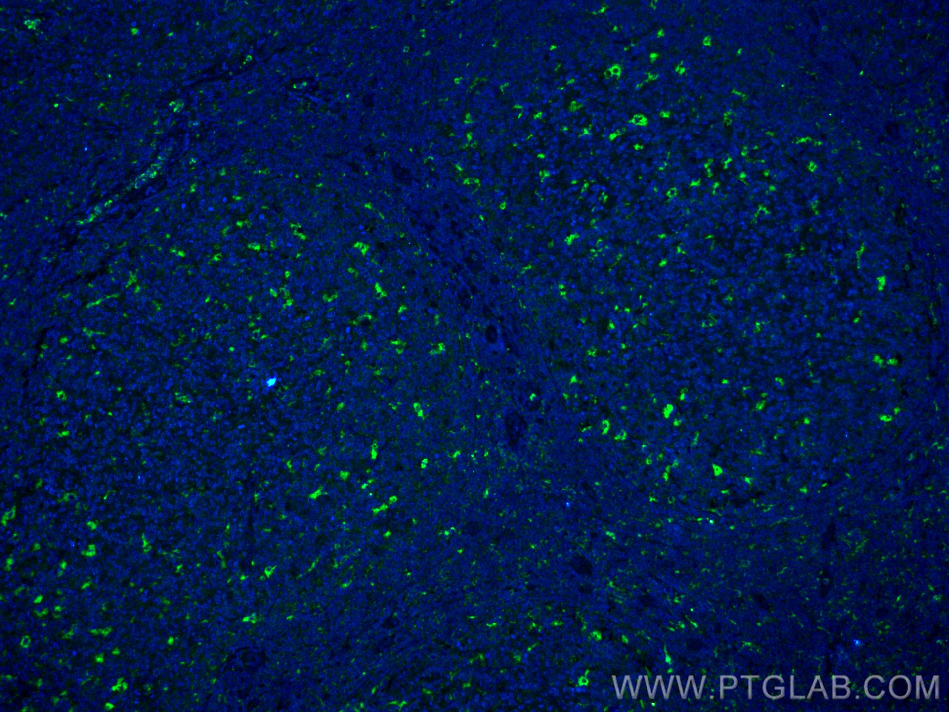 Human CCL18/PARC Fluorescein-conjugated Antibody IC394F: R&D Systems