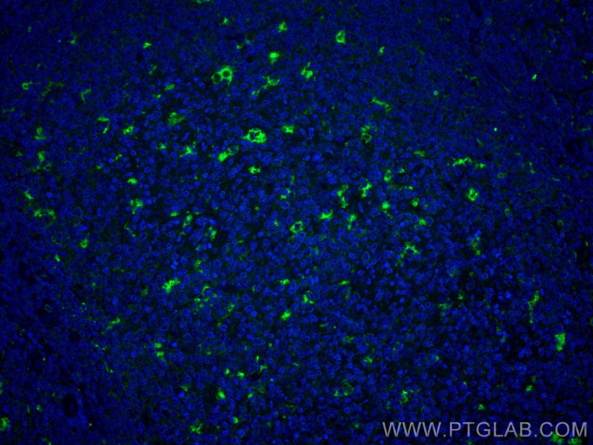 Immunofluorescence (IF) / fluorescent staining of human tonsillitis tissue using CoraLite® Plus 488-conjugated CD68 Polyclonal anti (CL488-25747)