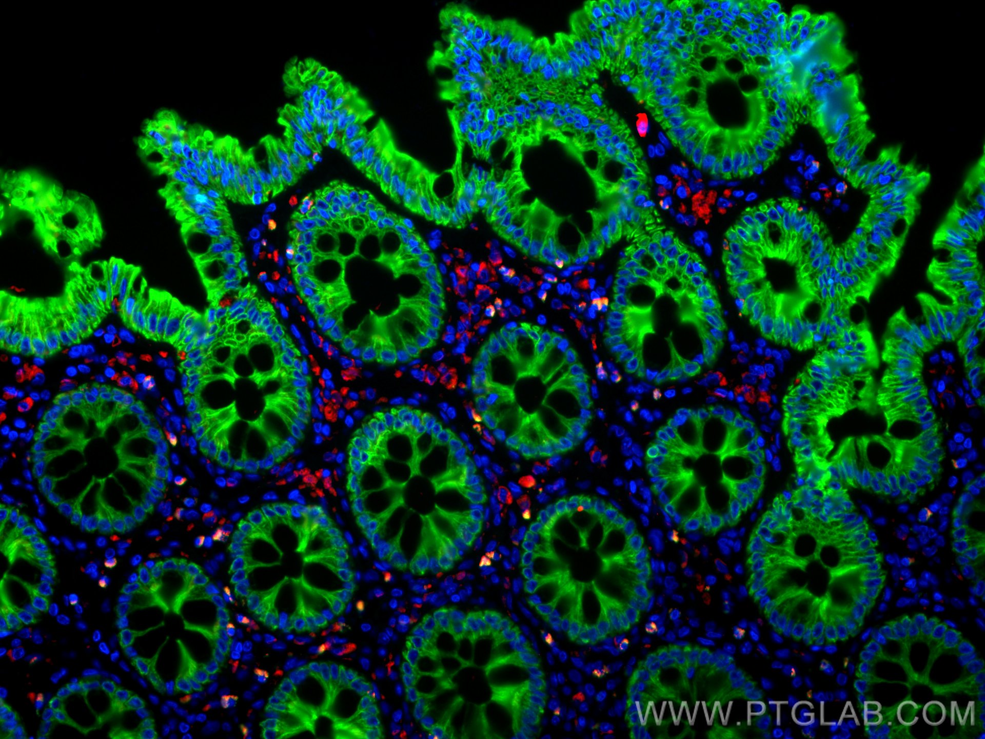 Immunofluorescence (IF) / fluorescent staining of human colon tissue using CoraLite®594-conjugated CD68 Polyclonal antibody (CL594-25747)