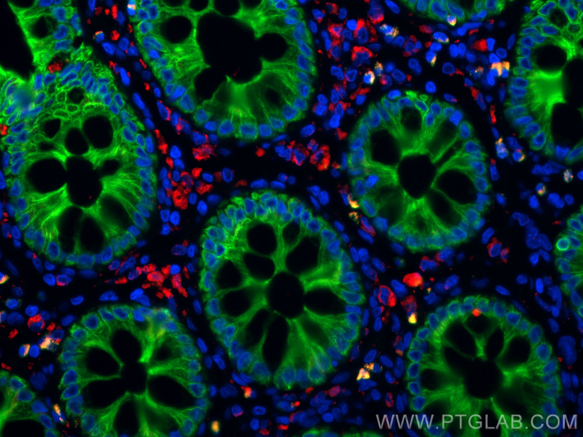 Immunofluorescence (IF) / fluorescent staining of human colon tissue using CoraLite®594-conjugated CD68 Polyclonal antibody (CL594-25747)