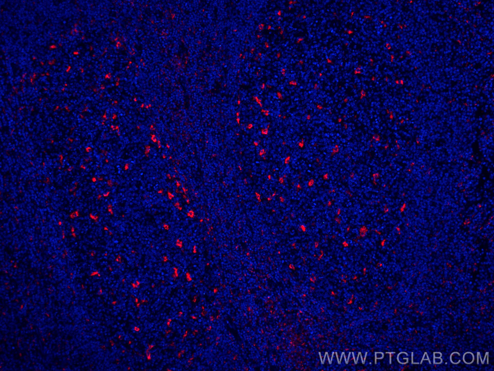 Immunofluorescence (IF) / fluorescent staining of human tonsillitis tissue using CoraLite®594-conjugated CD68 Polyclonal antibody (CL594-25747)