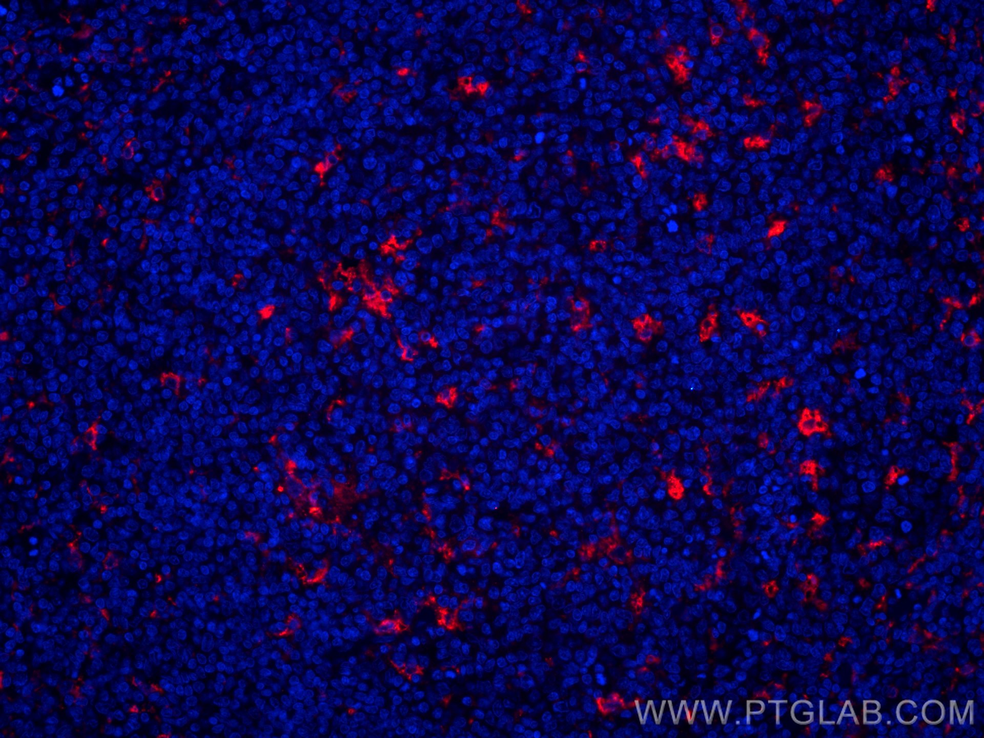 Immunofluorescence (IF) / fluorescent staining of human tonsillitis tissue using CoraLite®594-conjugated CD68 Polyclonal antibody (CL594-25747)
