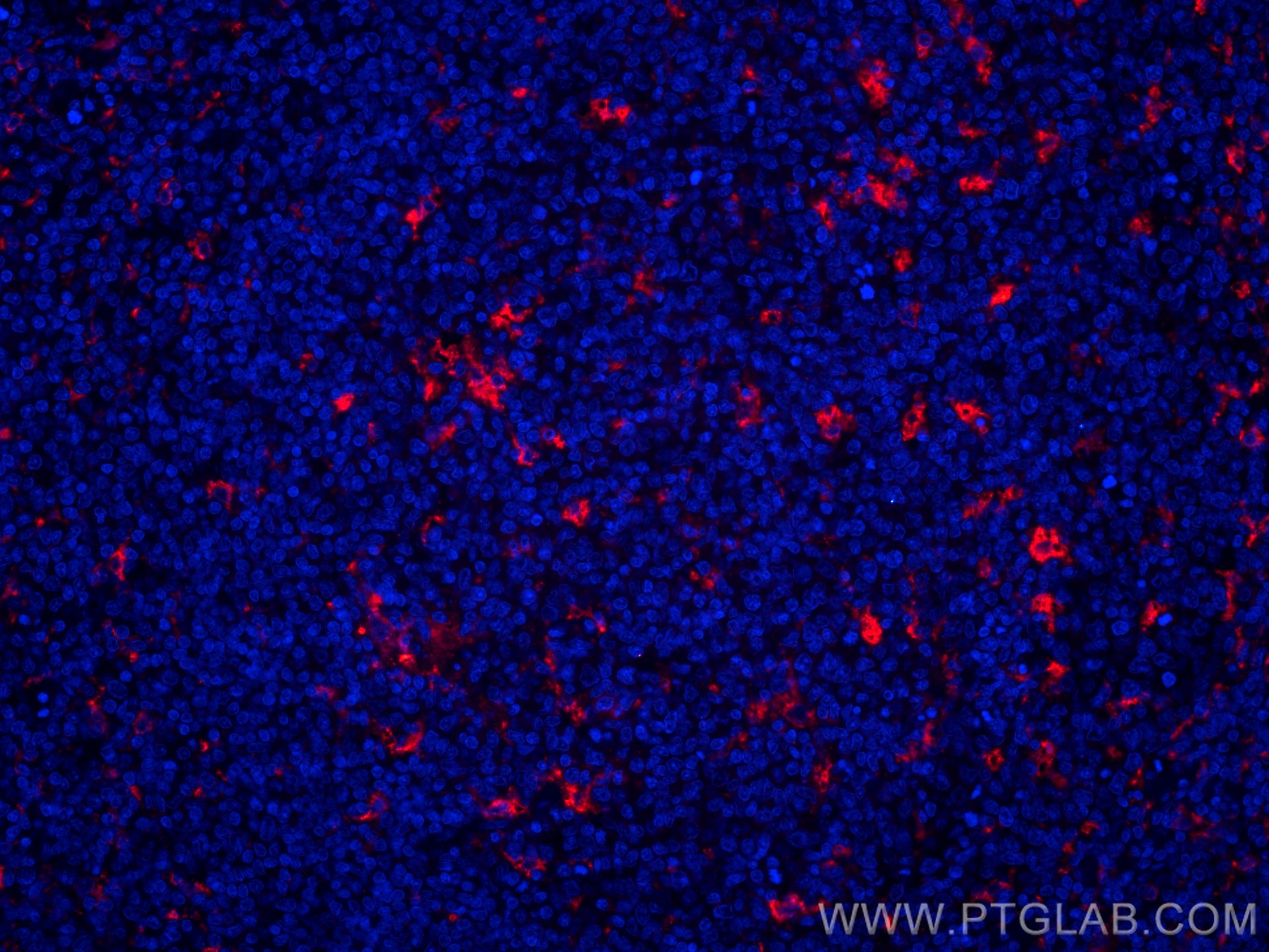 IF Staining of human tonsillitis using CL594-25747