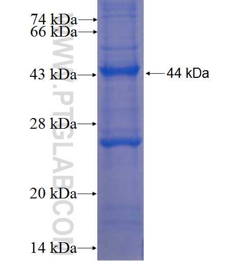 CD68 fusion protein Ag22815 SDS-PAGE