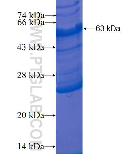 CD68 fusion protein Ag1215 SDS-PAGE