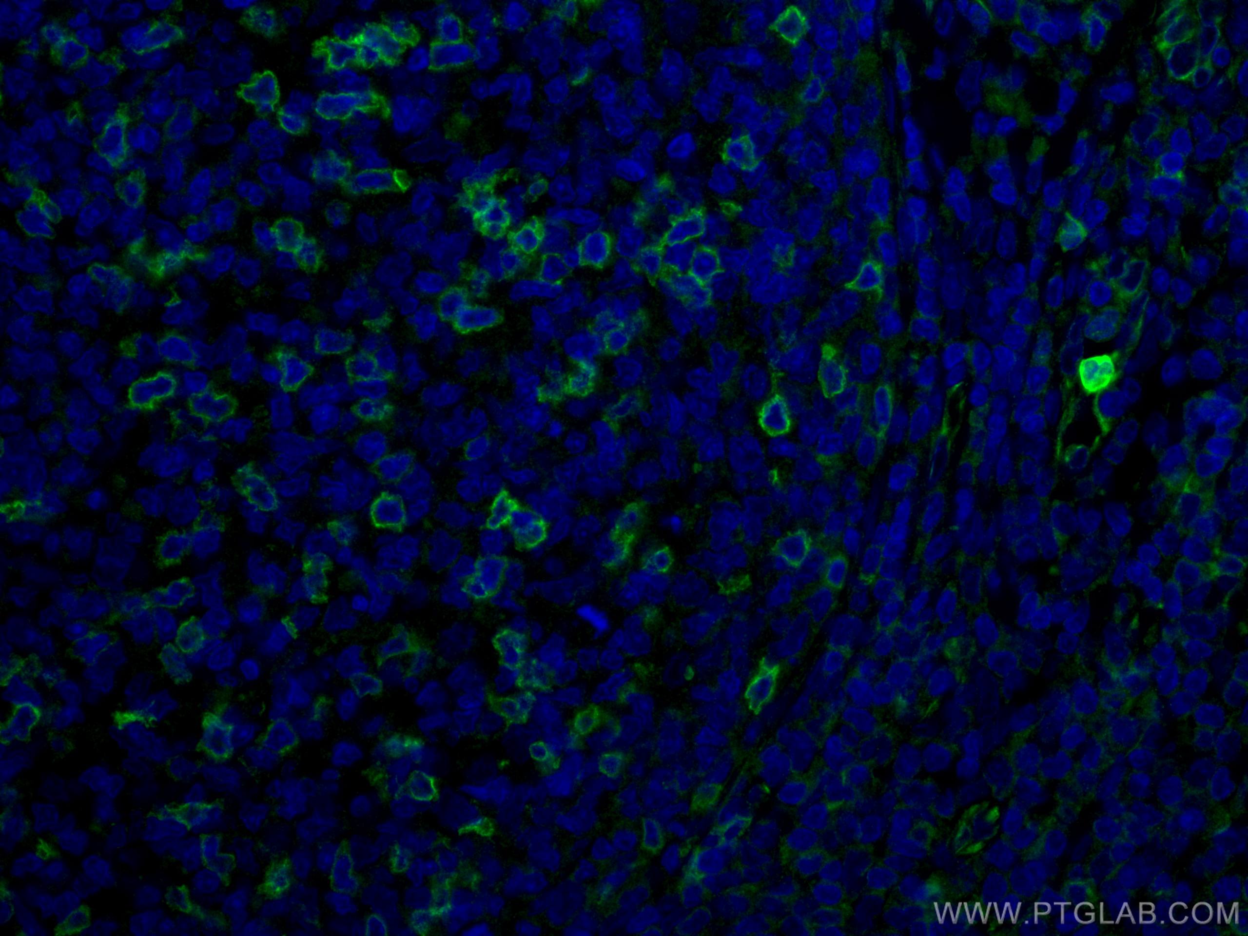 Immunofluorescence (IF) / fluorescent staining of human tonsillitis tissue using CD69 Polyclonal antibody, PBS Only (10803-1-PBS)