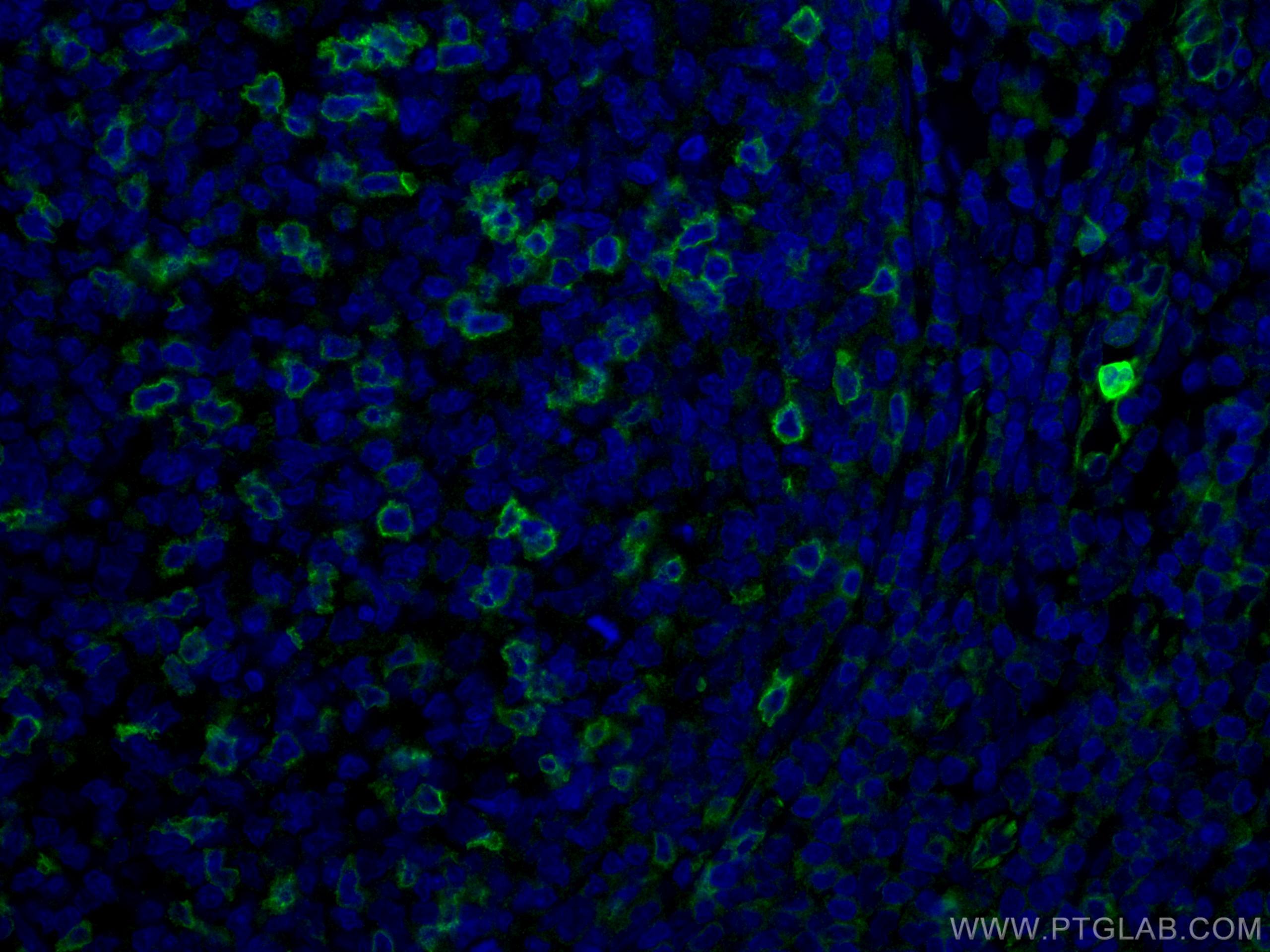 Immunofluorescence (IF) / fluorescent staining of human tonsillitis tissue using CD69 Polyclonal antibody (10803-1-AP)