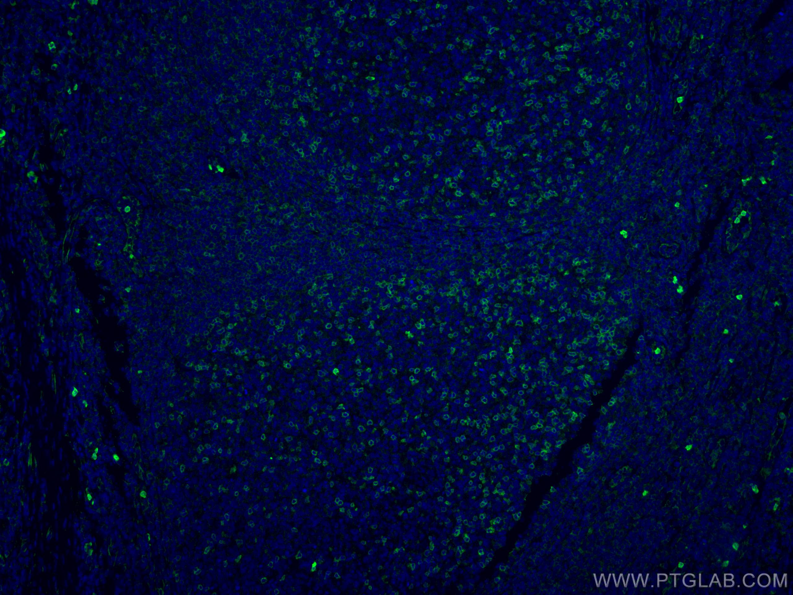Immunofluorescence (IF) / fluorescent staining of human tonsillitis tissue using CD69 Polyclonal antibody (10803-1-AP)