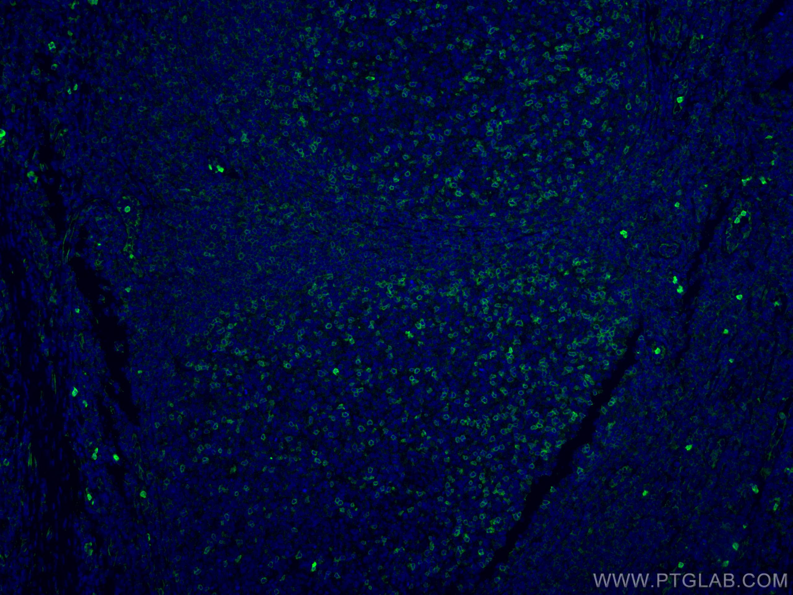 Immunofluorescence (IF) / fluorescent staining of human tonsillitis tissue using CD69 Polyclonal antibody, PBS Only (10803-1-PBS)