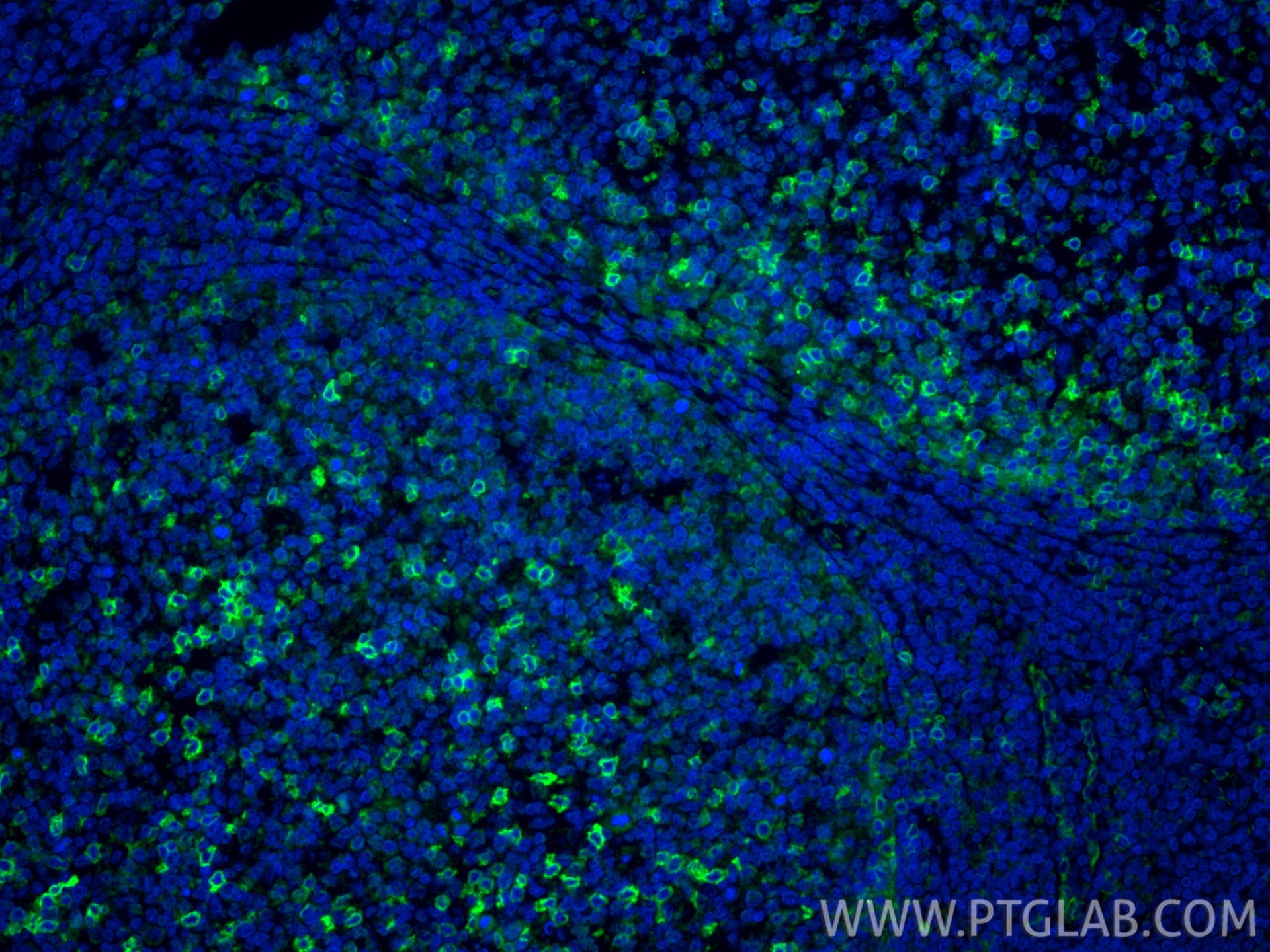 Immunofluorescence (IF) / fluorescent staining of human tonsillitis tissue using CD69 Polyclonal antibody (10803-1-AP)