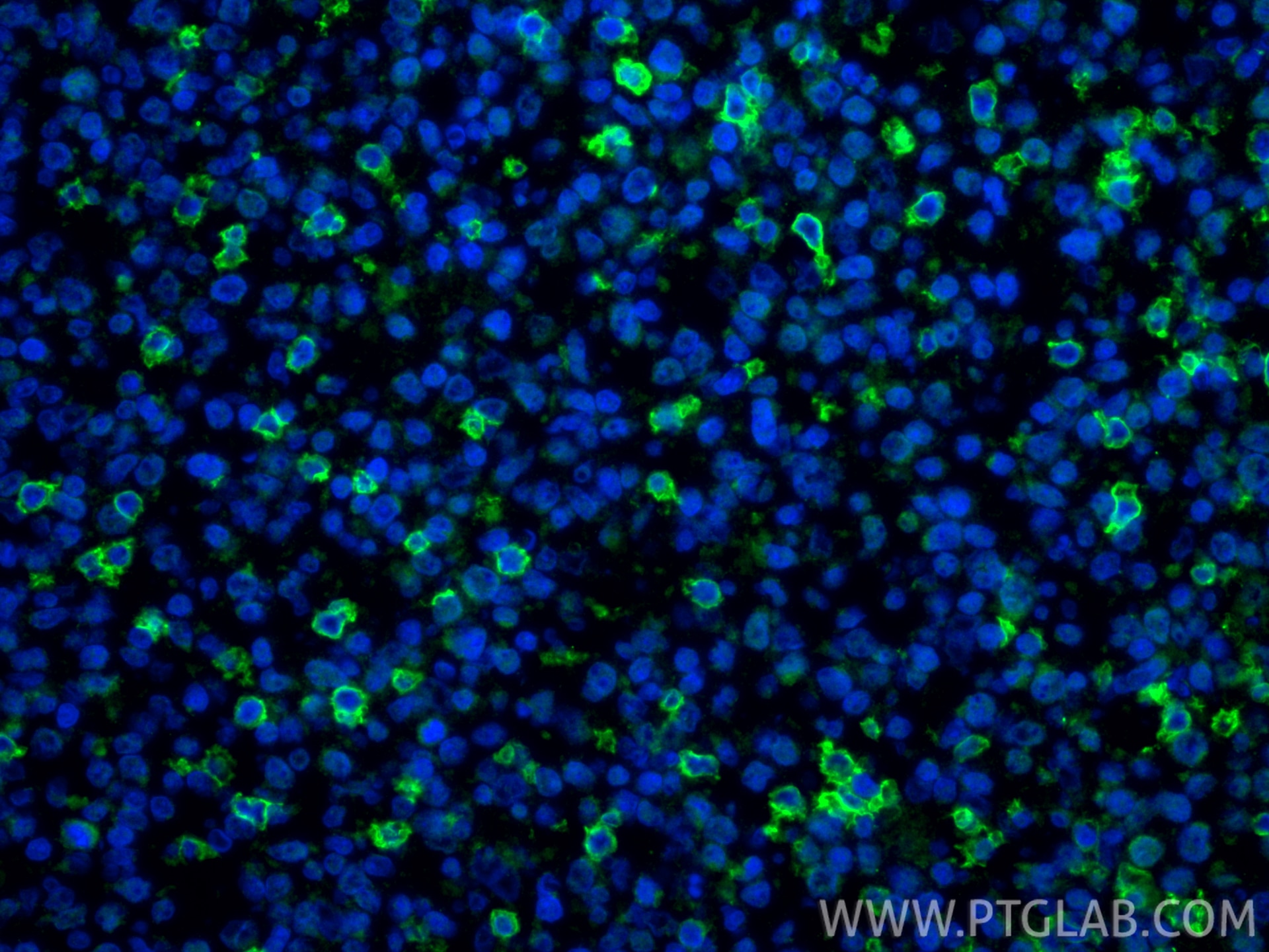 Immunofluorescence (IF) / fluorescent staining of human tonsillitis tissue using CD69 Polyclonal antibody (10803-1-AP)