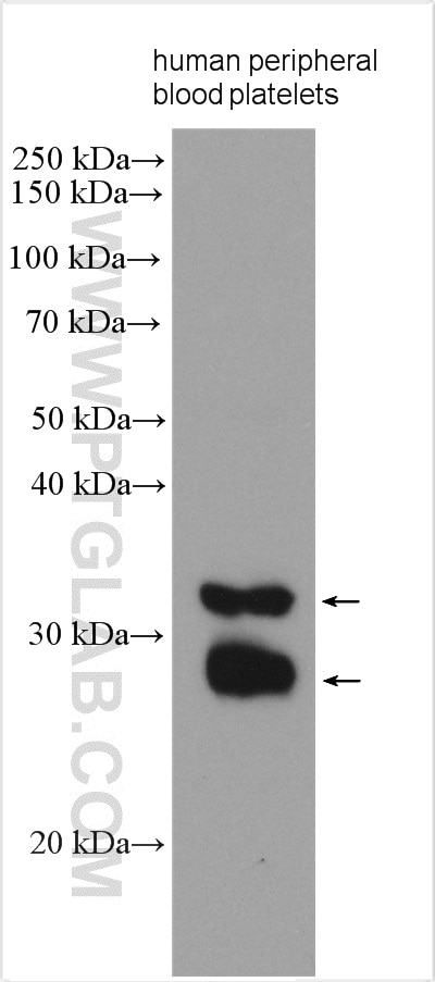Western Blot (WB) analysis of various lysates using CD69 Polyclonal antibody (10803-1-AP)