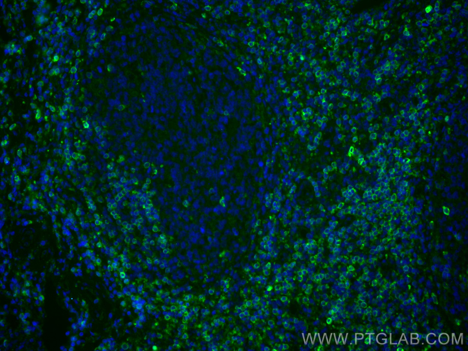 Immunofluorescence (IF) / fluorescent staining of human tonsillitis tissue using CD7 Polyclonal antibody (11320-1-AP)