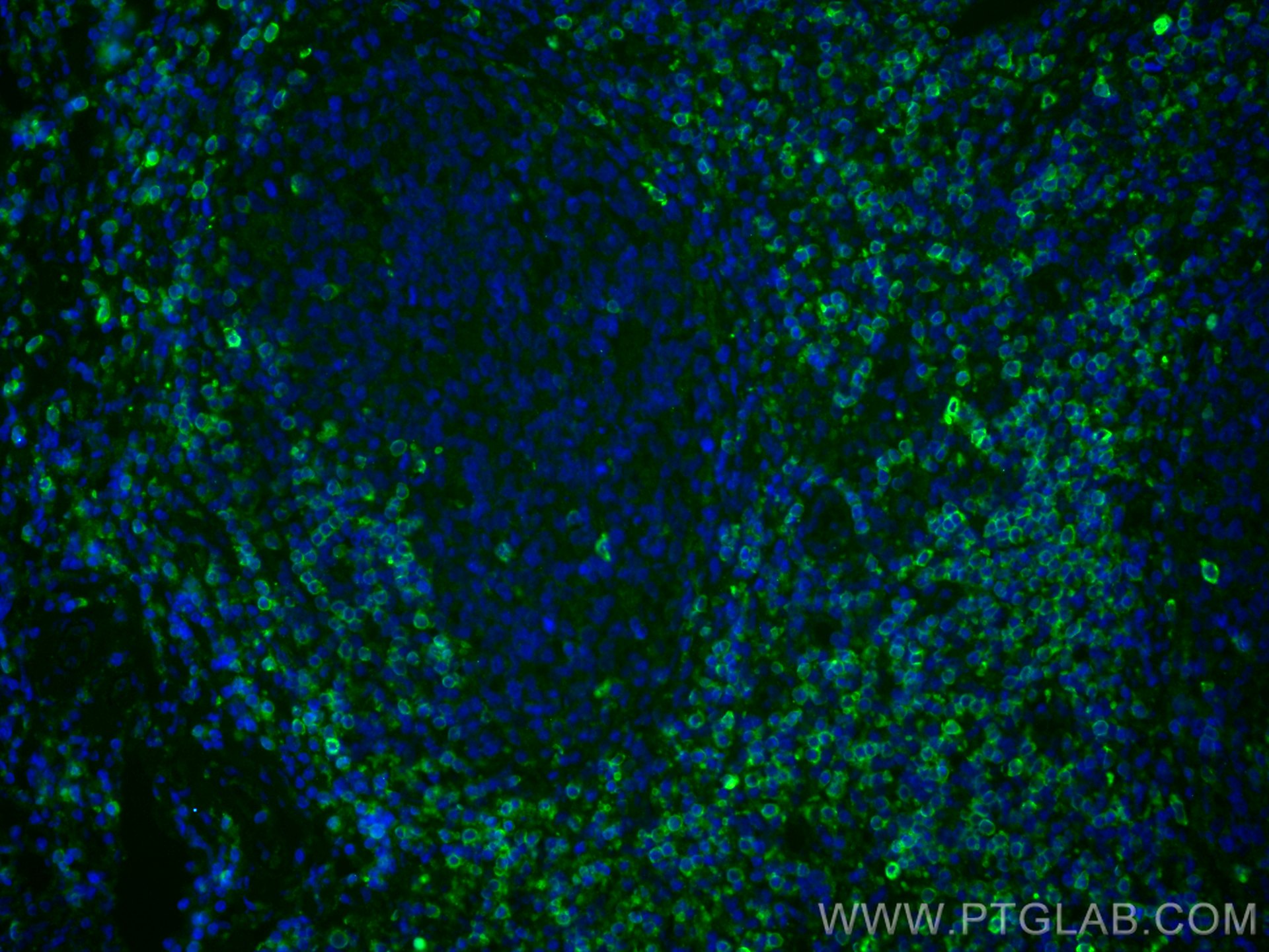 IF Staining of human tonsillitis using 11320-1-AP