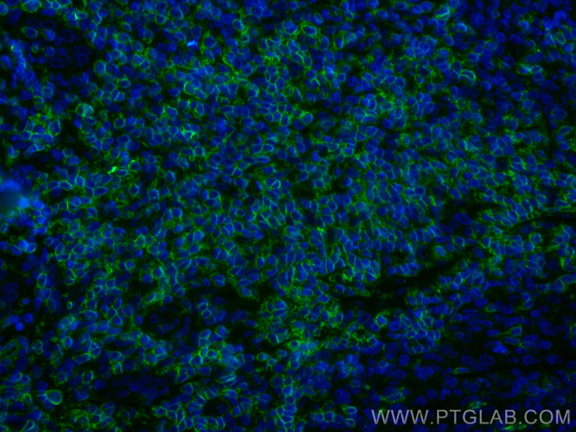 Immunofluorescence (IF) / fluorescent staining of human tonsillitis tissue using CD7 Polyclonal antibody (11320-1-AP)