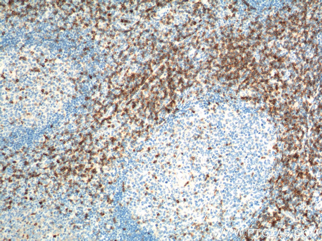 CD7 Polyclonal antibody