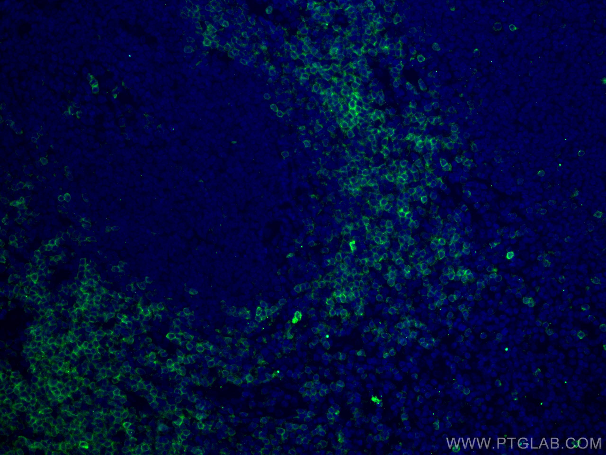 Immunofluorescence (IF) / fluorescent staining of human tonsillitis tissue using CD7 Monoclonal antibody (60209-1-Ig)