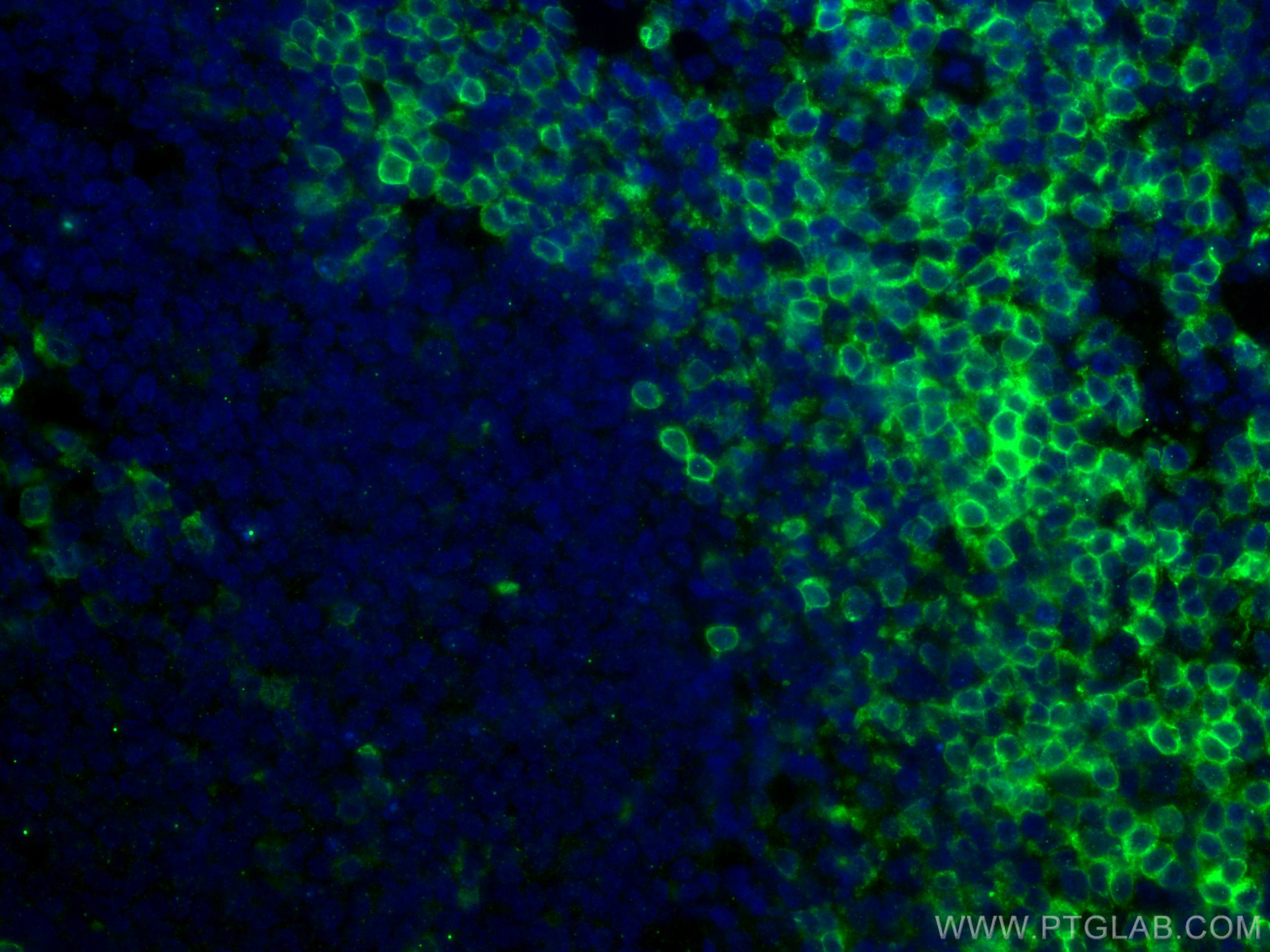 Immunofluorescence (IF) / fluorescent staining of human tonsillitis tissue using CD7 Monoclonal antibody (60209-1-Ig)