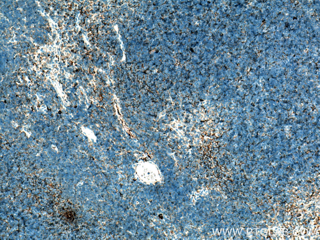 Immunohistochemistry (IHC) staining of mouse thymus tissue using CD7 Monoclonal antibody (60209-1-Ig)